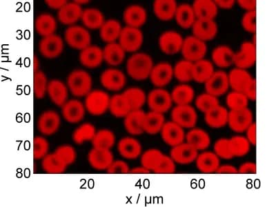 A micrograph of human red blood cells