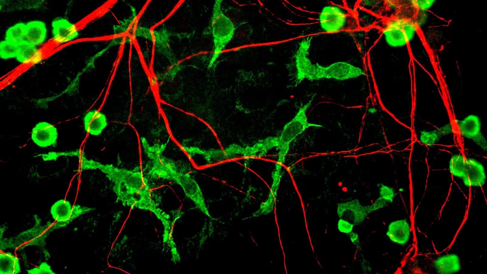 Microglia, stained green, among neurons stained red in a mixed rat brain cell culture