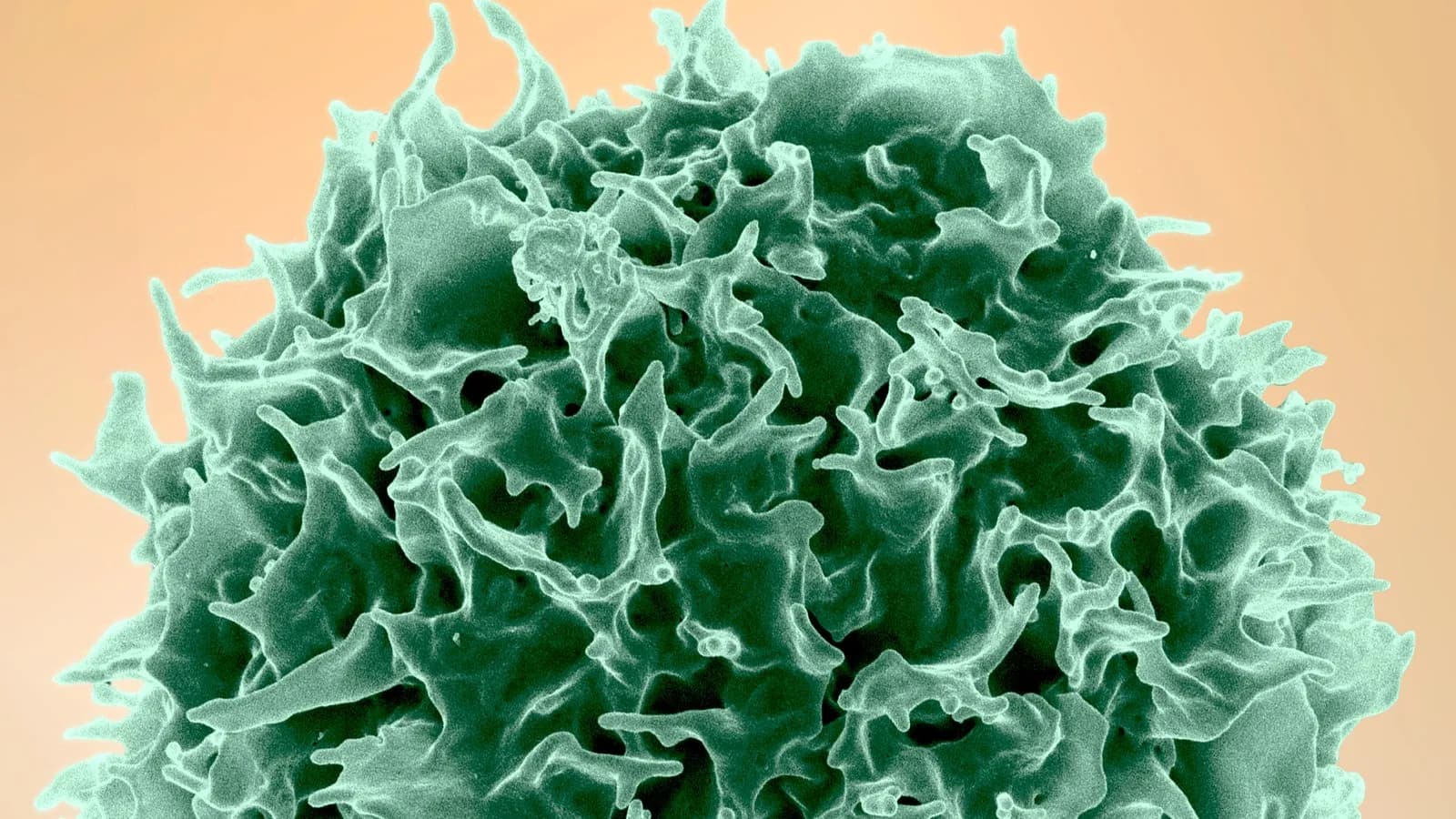 A colorized scanning electron micrograph of a healthy T lymphocyte, the cell type in which the lasting marks of obesity were found