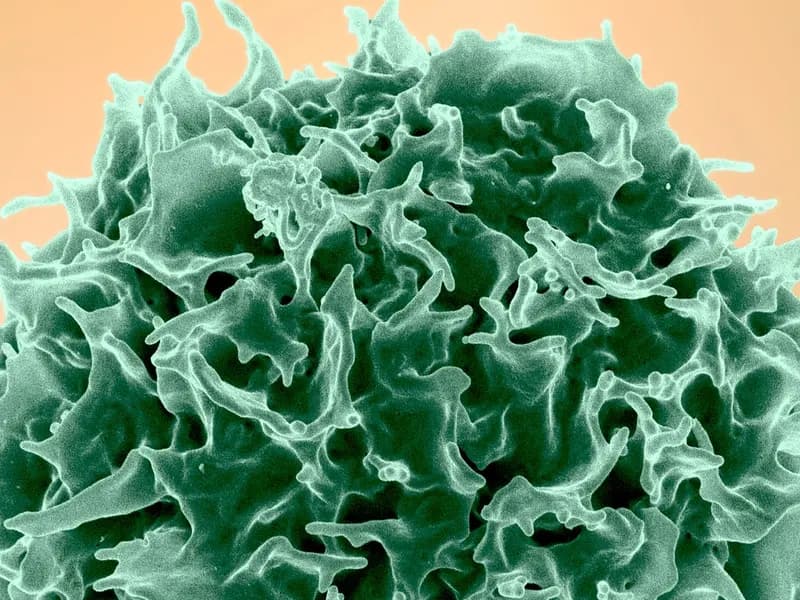 A colorized scanning electron micrograph of a healthy T lymphocyte, the cell type in which the lasting marks of obesity were found