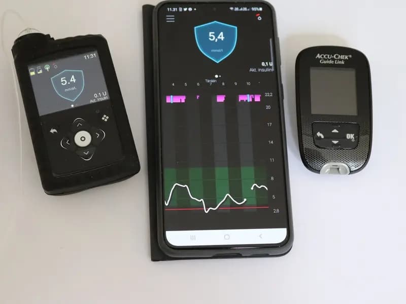 An insulin pump beside a phone app and a glucose meter