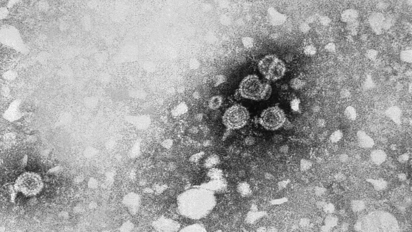 A black and white transmission electron micrograph of hepatitis B virus particles, photographed in 1981 by the US Centers for Disease Control and Prevention, a file image illustrative of the virus and not of Hibsago or its trials