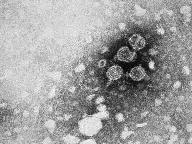 A black and white transmission electron micrograph of hepatitis B virus particles, photographed in 1981 by the US Centers for Disease Control and Prevention, a file image illustrative of the virus and not of Hibsago or its trials