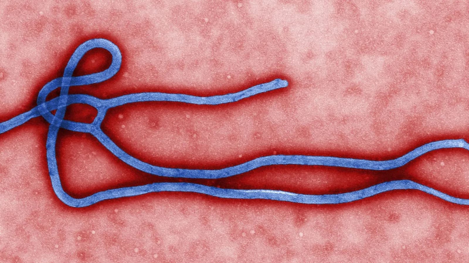 A colourised electron micrograph of an Ebola virus particle in blue on a red background, published by the US Centers for Disease Control, a file image illustrative of Ebola viruses in general and not of Kenya's cases