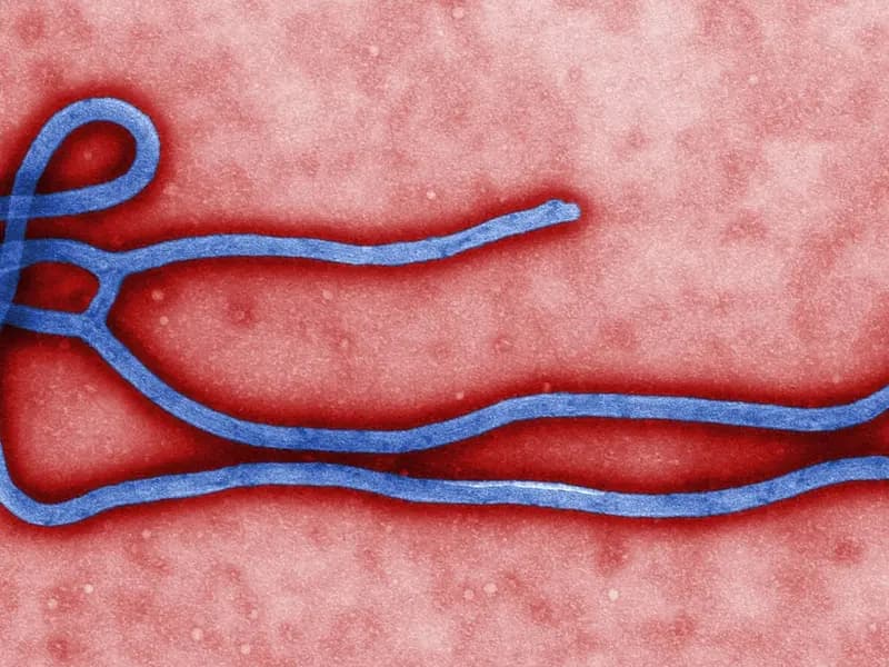 A colourised electron micrograph of an Ebola virus particle in blue on a red background, published by the US Centers for Disease Control, a file image illustrative of Ebola viruses in general and not of Kenya's cases
