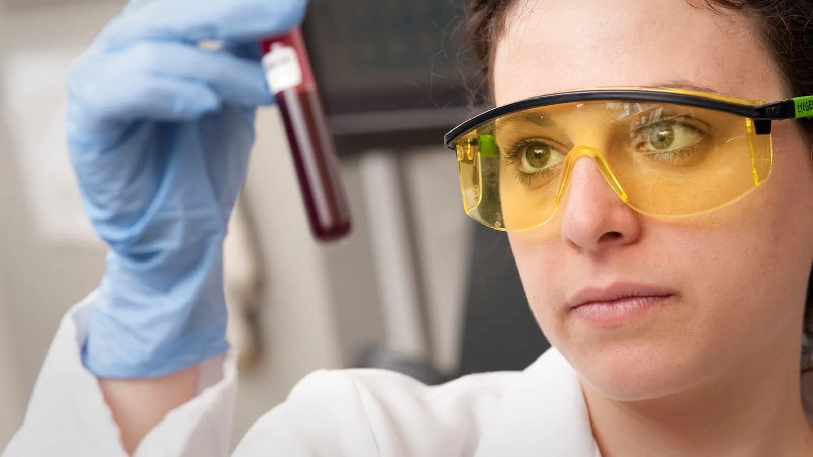 A blood sample being prepared for laboratory testing