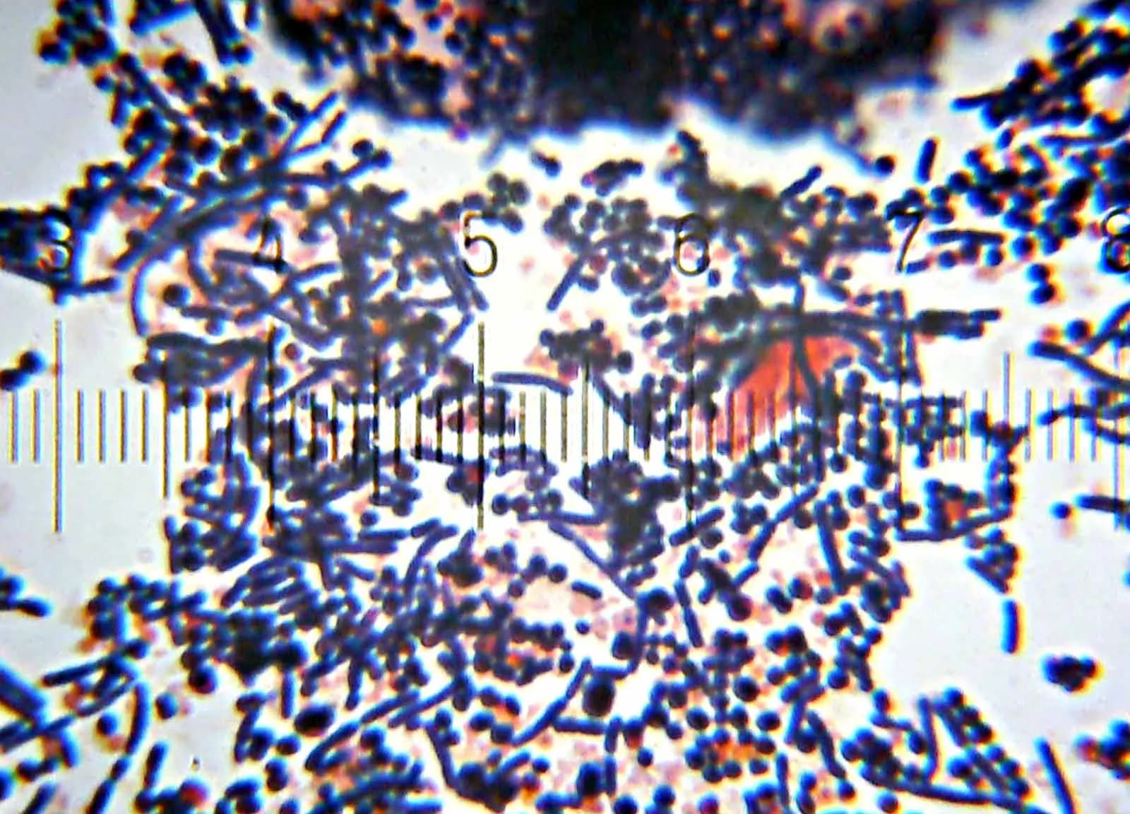 A laboratory technician examining culture plates